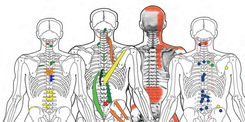 spine exam wte