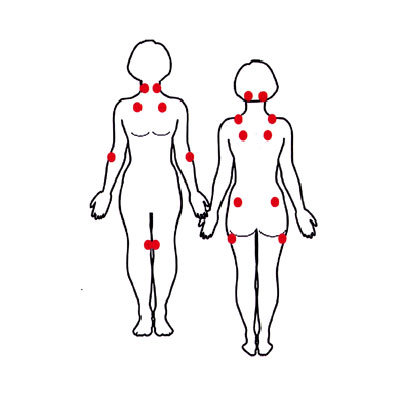 fibro-diagram-400x400